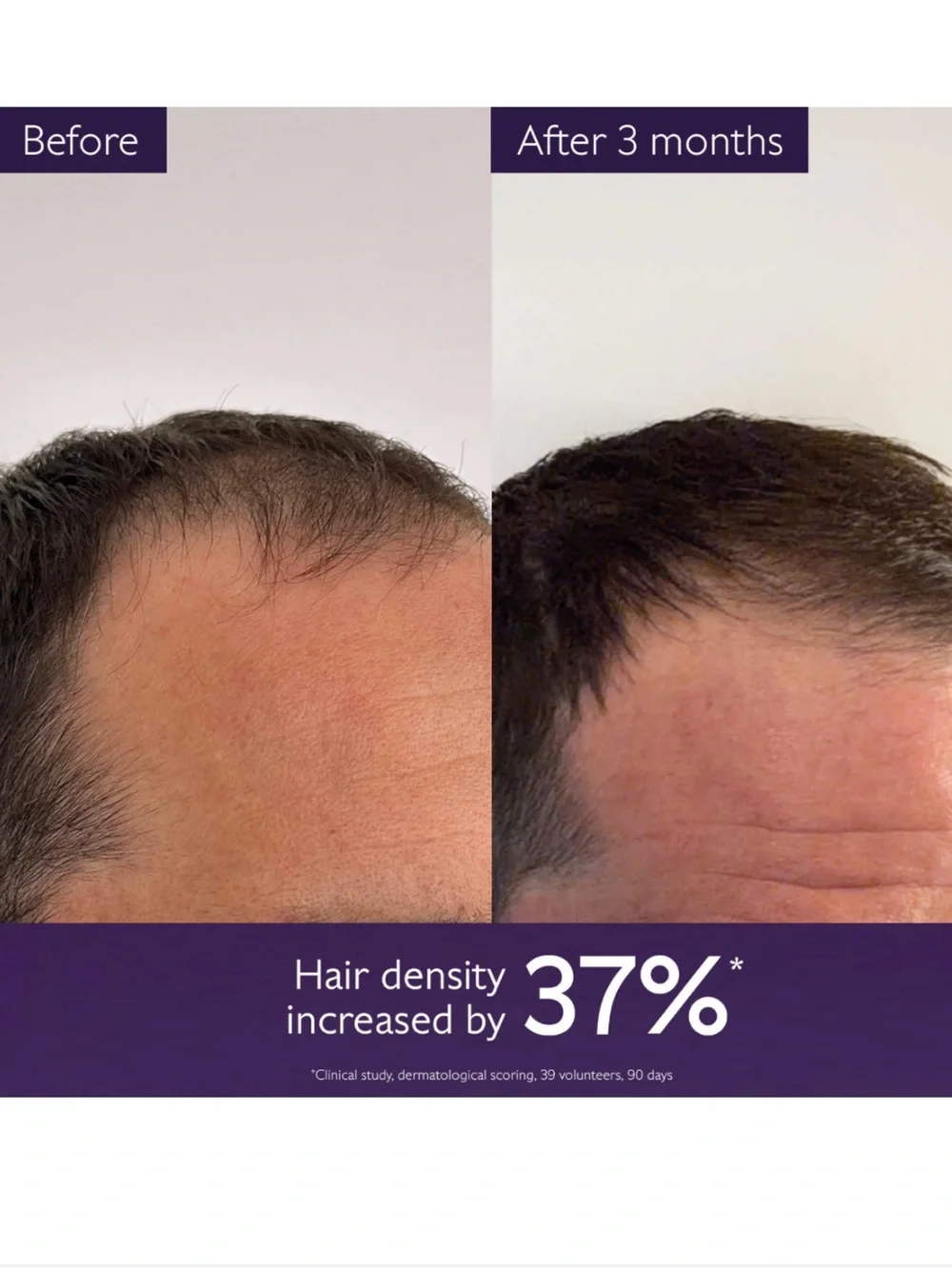 Caudalie Hair Density Serum for All Hair Types Thinning w Soothing Peptides NEW